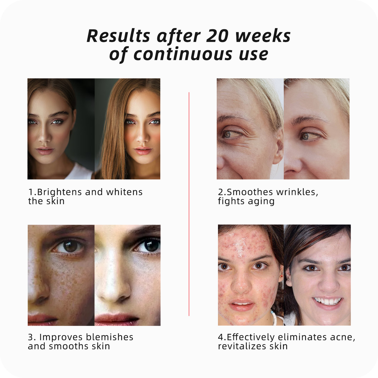 LED Red Light Beauty Mask