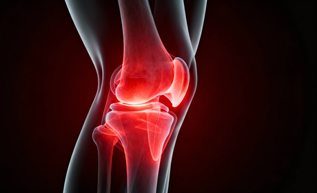 Does Red Light Therapy Work for Knee Pain?