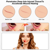 Fda Cleared ELVISH Cold Sore Treatment Device, Relieves Oral Ulcers, Nasal, Ear, Knee, Hand, Joint, Muscle & Nerve Pain, 460/630/660/850/900nm Wavelengths, Built-in Timer, 3 Flash Frequencies, 4 Home Modes, Teacher & Father'S Day Appreciation Gifts